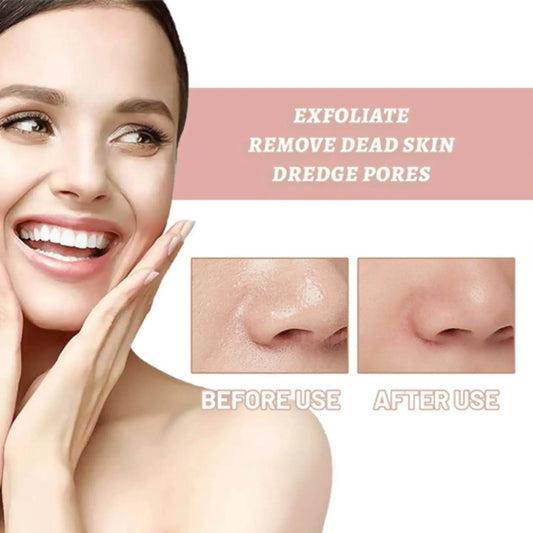 Woman smiling with clear skin, product benefit text, and before and after nose pore comparison for exfoliation.