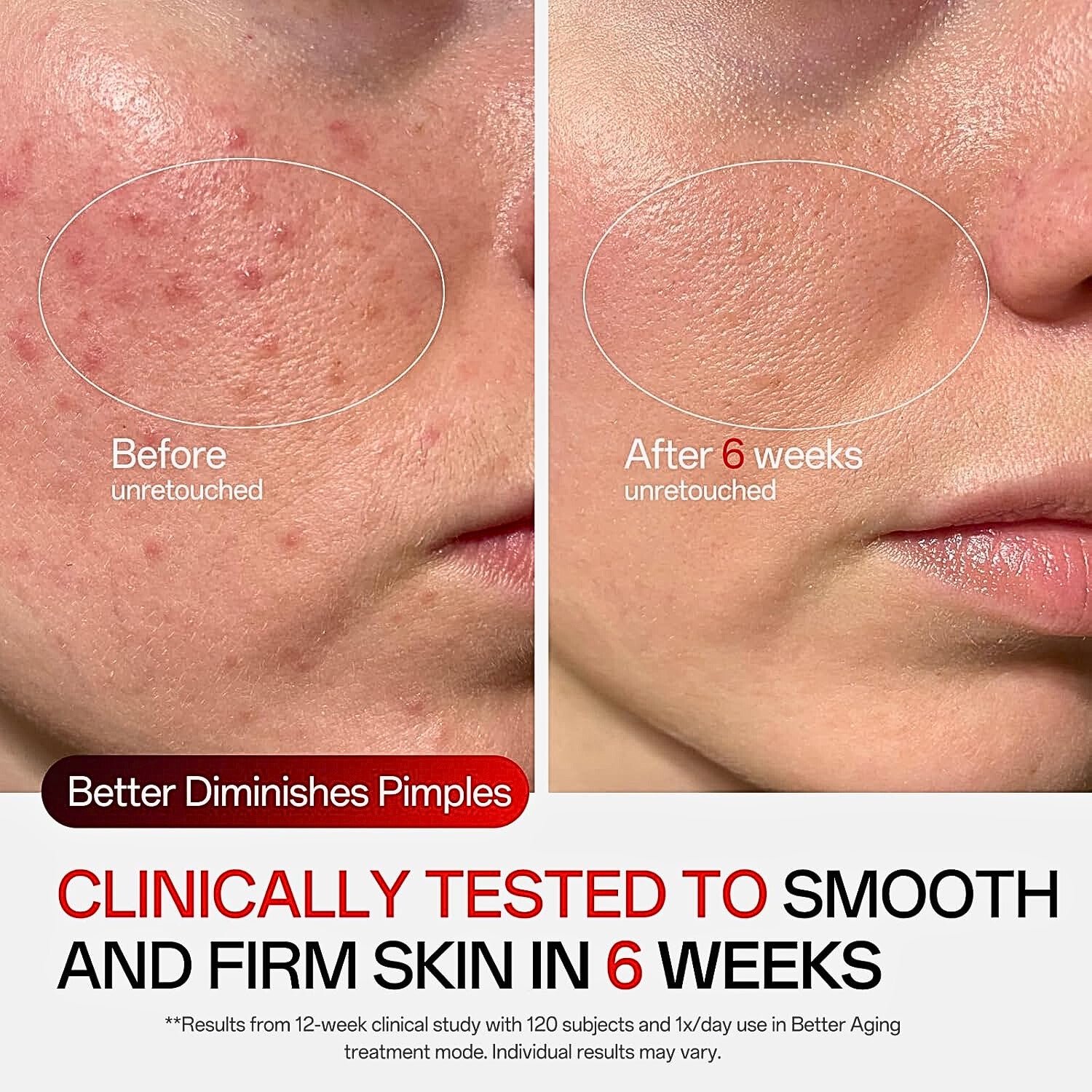 TISHLED retro mechanical gaming keyboard (Matcha Green) — 104-Key NKRO, White LED, Volume Knob, USB-C Strike Algo